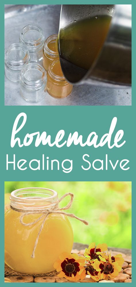 Make your own Homemade Salve for a versatile way to treat rashes, bumps, bites, and more! Homemade Salve Recipes, Homemade Healing Salve, Salves And Balms, Indigestion Remedies, Healing Salve Recipe, Homemade Salve, Medicinal Oils, Healing Salve, Salve Recipes