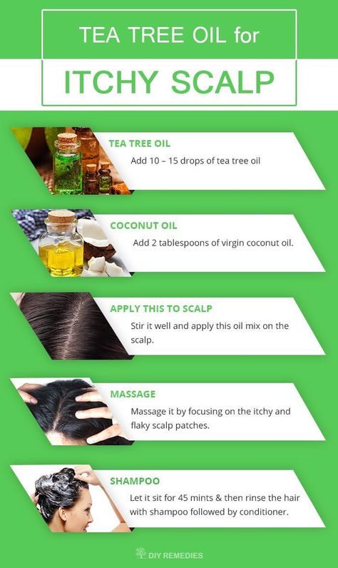 Best Tea Tree Oil, Shampoo Diy, Benefits Of Coconut, Getting Rid Of Dandruff, Flaky Scalp, Benefits Of Coconut Oil, Itchy Scalp, Hair Remedies, Natural Remedy