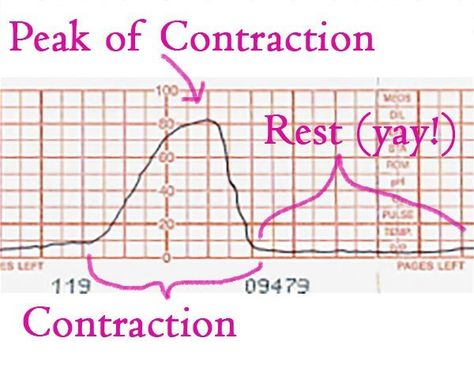 The Complete Guide to Timing Labor Contractions How To Time Contractions, Contractions Labor, Early Labor, Active Labor, Medical Advice, Labor, Writing