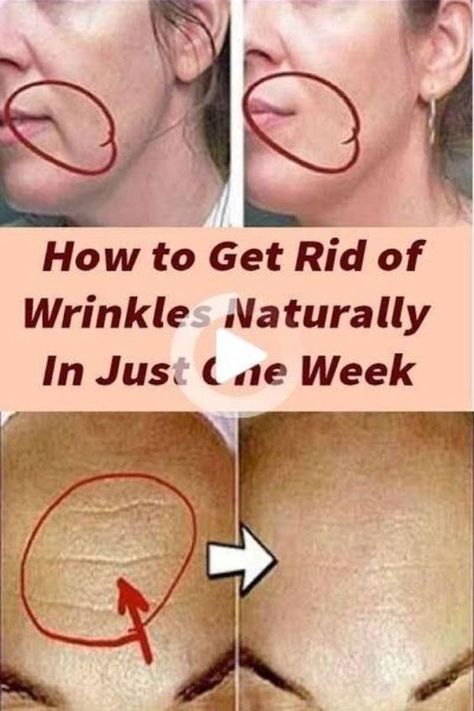 >>CHECK THIS OUT<< How to Prevent Wrinkles: Natural Anti-Aging Wrinkle Remedies Regular Skin Care Routine, Get Rid Of Wrinkles, Wrinkle Remedies, Skin Lightener, Wrinkle Free Skin, Proper Skin Care, Anti Aging Wrinkles, Best Skin Care Routine, Natural Anti Aging