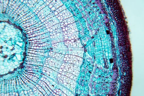 Plant Stem under the microscope for classroom education. Close up Plant Stem und , #affiliate, #microscope, #Stem, #Plant, #classroom, #href #ad Plant Classroom, Stem Plant, Under The Microscope, Plant Stem, Anatomy, Design Art, Close Up, Photo Image, Stock Photos