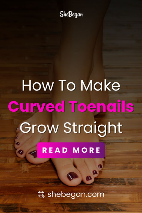 Having a curved toenail can create a sense of urgency to straighten it up as this could be an early sign of nail impairment. This pin explores how you can make curved toenails straight when you notice this abnormality. Curled Toenails, Hammer Toe Correction, Curved Toenails, Nail Remedies, Sense Of Urgency, Toe Straightener, Nail Infection, Ingrown Toe Nail, Good Health Tips