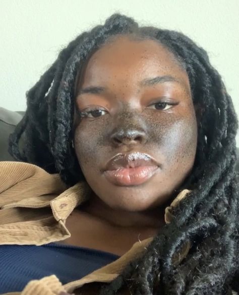 Freckles On Brown Skin, Big Lips Aesthetic, Freckles On Dark Skin, Dark Skinned Black Women, Big Lips Natural, Women With Freckles, Black Nose, Pretty Skin, Dark Skin Women