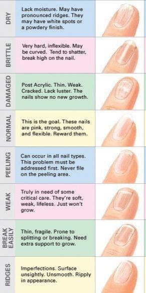 Fingernail Health, Emerald Nails, Health Chart, Health Signs, Tongue Health, Nagel Tips, Nail Care Tips, How To Grow Nails, Nail Growth