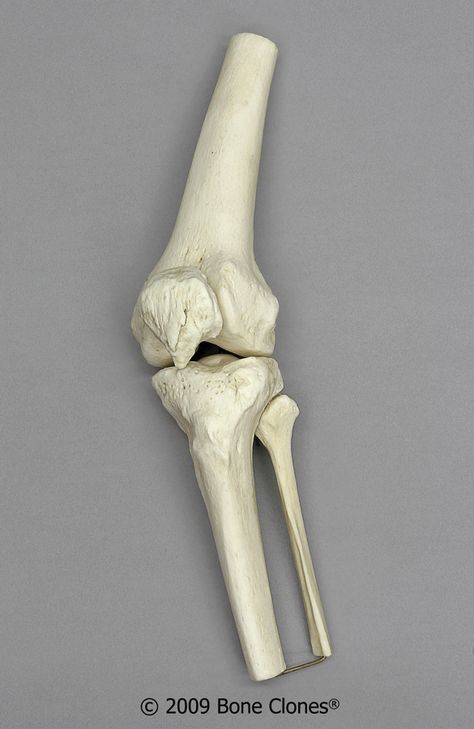 Bone Clones® bag for skulls and skeletal parts. Description from boneclones.com. I searched for this on bing.com/images Human Knee, Human Skeleton, Skeletal, The Knee, Skeleton, Bones, Human