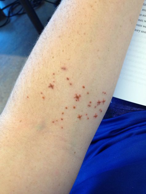 Brown ink. Pleiades star cluster. Constellation tattoo. Inside the elbow tattoo. The Elbow Tattoo, Pleiades Star Cluster, Brown Tattoo Ink, Browning Tattoo, Elbow Tattoo, Constellation Tattoo, Elbow Tattoos, Constellation Tattoos, Star Cluster