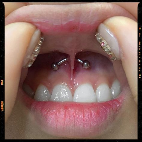 Smiley Piercing - Piercing Idea Cheeks Piercing, Smile Piercing, Gummy Smile, Piercing Inspo, Smiley Piercing, Jewelry Piercing, Airbrush App, Piercings Unique, Body Jewelry Piercing