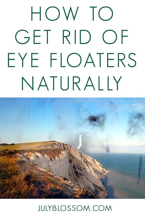 With these 7 natural remedies for eye floaters, you may be able to reduce or get rid of those vision disturbances! Eye Health Remedies, Eye Floaters, Anti Oxidant Foods, Eye Pain, Facial Steaming, Eye Exercises, Eye Sight Improvement, Essential Oil Mixes, All Nighter