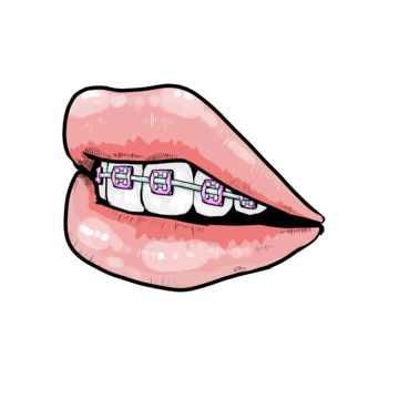 Mouth With Braces Drawing, Easy Drawings Mouth, Braces Illustration, Mouth Clipart, Dental Stickers, Pink Braces, Mouth Cartoon, Braces Smile, Dentist Teeth