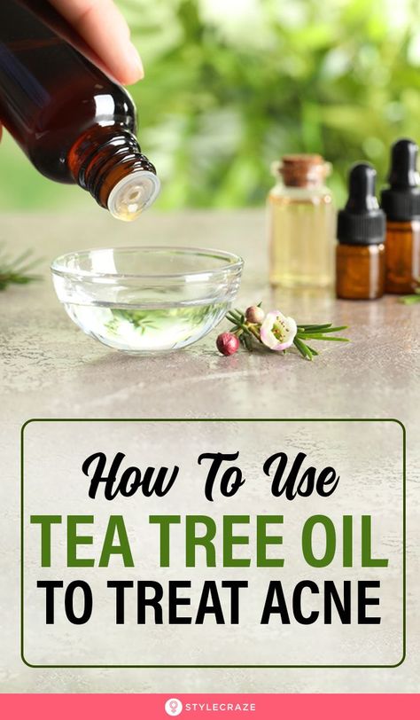 Tee Tree Oil, Tea Tree Oil Face, Tea Tree Oil For Acne, Diy Acne, Natural Acne, Acne Oil, Treat Acne, Acne Problem, Acne Remedies