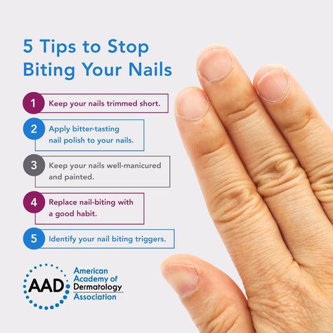 Repeated nail biting can lead to tissue damage and leave you vulnerable to infection. Kick the habit with these dermatologist tips: Stop Biting Your Nails, Nail Biting Habit, Make Nails Grow, Biting Nails, Antifungal Cream, Nail Infection, Nail Biting, Nail Growth, Deep Wrinkles