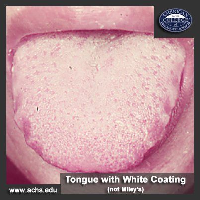 Miley Cyrus Tongue, Nails Remedies, Burning Tongue, Nail Remedies, White Tongue, Liver Issues, Nutrition Course, Tongue Health, Food As Medicine