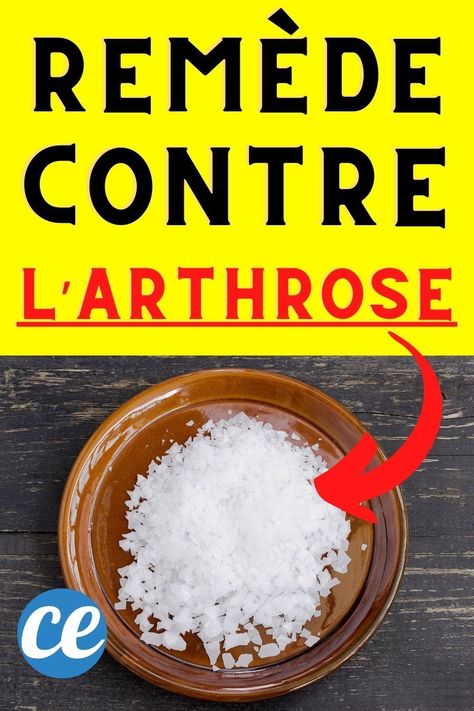 Vous cherchez un traitement naturel contre l'arthrose ? Arthrose au genou, main, hanche, cervicale... C'est douloureux. Heureusement il existe un remède naturel efficace pour soulager l'arthrose, les douleurs articulaires et les rhumatismes. Ce soin maison c'est le chlorure de magnésium. Voici comment faire : Makeup For Droopy Eyelids, Droopy Eyelids, Vicks Vaporub, Wellness Tips, Medicine, Nutrition, Health