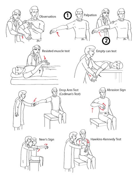 Diagnosing Supraspinatus Tears Supraspinatus Exercises, Shoulder Tear Exercises, Respiratory Physiotherapy, Neuro Physiotherapy, Supraspinatus Tendon Tear, Supraspinatus Muscle, Physiotherapy Memes Funny, Physiotherapy Exercises, Benefits Of Physiotherapy