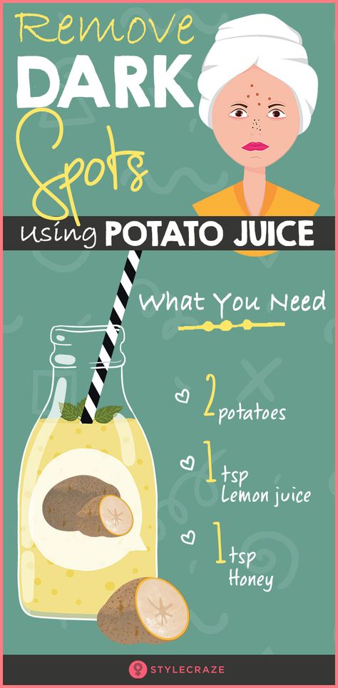 How To Use Potato For Dark Spots, How To Remove Brown Spots On Face, Potato For Dark Spots, Potato Face Mask Dark Spots, Potato Face Mask, Dark Spots Remedies, Healthy Hacks, Baking Soda Face, Potato Juice