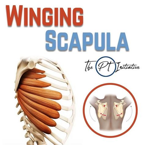 Neck Pain | Back Pain on Instagram: "💥Scapular Winging + Serratus Anterior💥 (Swipe Left!...) 🔑The serratus anterior is an important muscle that sits underneath your shoulder blade and wraps around the side to your ribs. It plays a significant role in keeping your scapula moving optimally when reaching overhead. 🛠If you have been dealing with a winging scapula or need some better stability at the shoulder blade, these are a good place to start! ✅ I interpret scapular winging more of a movemen Scapular Winging, Winged Scapula, Serratus Anterior, Joints Pain Relief, Functional Training, Injury Prevention, Neck Pain, Back Pain, Instagram