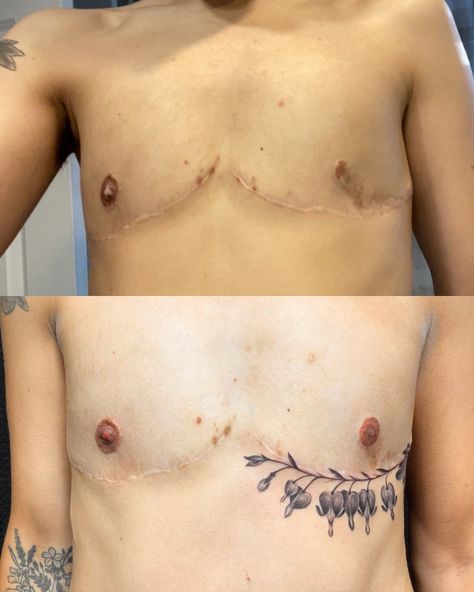 Top Surgery Tattoo Flower, Trans Masc Chest Tattoos, Top Surgery Chest Tattoo, Chest Surgery Tattoo, Tattoos Top Surgery, Top Surgery Scar Coverup Tattoo, Post Top Surgery Tattoos, Too Surgery Tattoo, Tattoos To Cover Top Surgery Scars