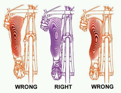 Power...| I like this. For with a chronically geeked right knees I have my right pedal and cleat adjusted for float and slight very slight pronating. Bike Fitting, Bow Legged Correction, Cycle Training, Bow Legged, Ride Bike, Bike Training, Cycling Tips, I Want To Ride My Bicycle, Bike Pedals