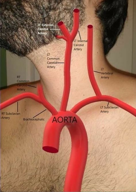 Arch Of Aorta, Aorta Branches, Aortic Arch, Heart Rhythm, Nursing School Essential, Medical School Life, Medicine Studies, Basic Anatomy And Physiology, Nurse Study Notes