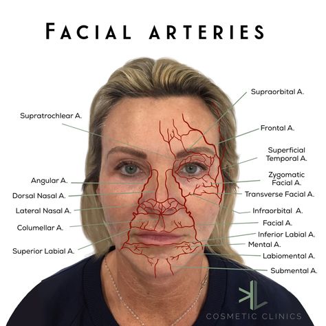 Instagram: KL Cosmetic Clinics Facial Injections, Esthetician Inspiration, Skin Anatomy, Aesthetic Dermatology, Facial Anatomy, Botox Face, Face Anatomy, Facial Fillers, Cosmetic Injectables