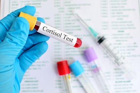 Thyroid Test Results, Low Ferritin, Thyroid Levels, Thyroid Test, Cholesterol Test, Thyroid Medication, Vitamin D Supplement, Lower Your Cholesterol, Thyroid Function