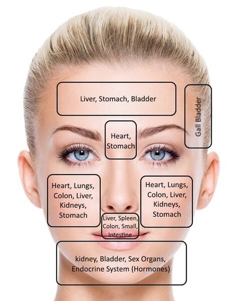 Im having breakouts under at the bottom of my cheeks. I love this face map to get to the bottom of what needs more love in my body. Kidney failure & problems are an issue for burn survivors so it looks like a healthy dose of cranberry juice and working through anger surfacing aka fear will do the trick. Did you know blemishes are the emotion of anger surfacing? Its so cool to me how our body sends us messages like a map to what it needs. XOXO #skin #skincare #acne #glow Doterra Acne, Gesicht Mapping, Acne Face Map, Endocrine System Hormones, Face Map, Skin Breaking Out, Face Mapping Acne, Face Mapping, Acne Face