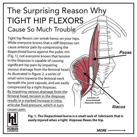 Iliopsoas Stretch, Tight Hip Flexors Stretches, Orthopedic Anatomy, Iliopsoas Muscle, Hip Pain Causes, Hip Release, Stiff Hips, Exercises For Strength, Full Body Stretching Routine