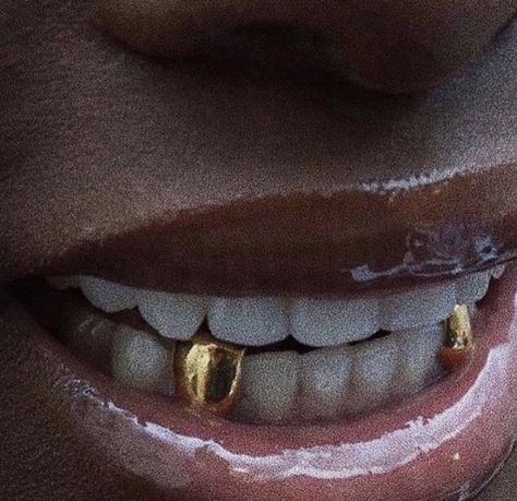 x$♡ on Twitter: "want grills so much..… " Gold Teeth, Braces, Gold, Instagram