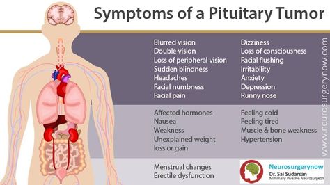 Pituitary gland is a small endocrine gland situated just below the brain. Know more about the symptoms and treatments of #PituitaryTumors. Visit : www.neurosurgerynow.com/pituitary-tumors/ Pituitary Adenoma, Pituitary Gland Disorders, Pituitary Gland Tumor, Pituitary Tumor, Nursing Mnemonics, Anatomy Physiology, Pituitary Gland, Migraine Relief, Adrenal Fatigue