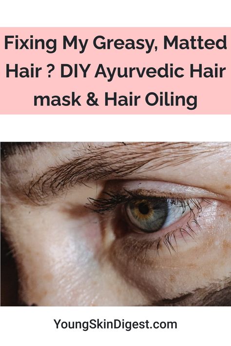 Let’s face it, greasy hair is no fun! Grease buildup causes strands to look dull, oily and limp. It also leads to split ends and tangles. You can get rid of the grease by washing your hair every day and using a quality shampoo, but what if you have oily hair? What are your options if you have greasy hair? Well, I have the answer for you. The good news is that greasy hair doesn’t need to be a challenging problem.In this blog post, I will show you 3 simple DIY home remedies that work wonders on gr Ayurvedic Hair Mask, How To Treat Dandruff, Yogurt Mask, Hair Oiling, Ayurvedic Hair Care, Hair Mask Recipe, Homemade Hair Mask, Matted Hair, Mask Hair