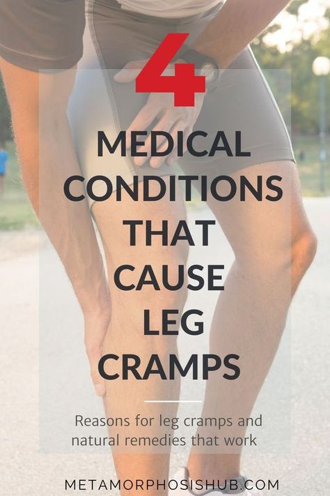 Not all leg cramps are caused by over exertion or electrolyte deficiencies. They may be caused by these medical conditions...............more on website #SeniorCare #legcramps #legs #health #medical Leg Pain Relief Remedies, Severe Leg Cramps, Leg Cramps Causes, Nerve Pain Remedies, Leg Cramps At Night, Calf Cramps, Pain Relief Remedies, Cramps Relief, Leg Cramps