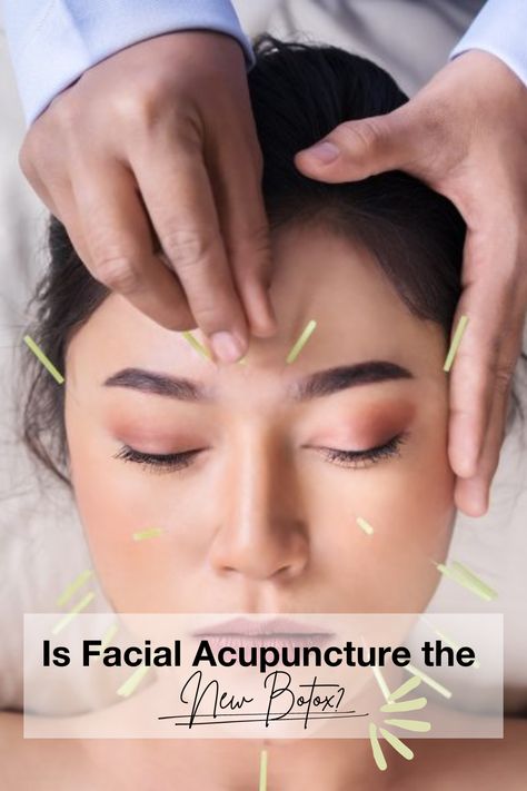 Embrace Youthful Glow! 💫 From fillers to Botox, and now, holistic trends like facial acupuncture. 🌺 Revive your radiance naturally with increased blood flow, plumper skin, and fewer lines. Meet Gudrun Snyder, founder of @moonrabbitacupuncture, sharing all about facial acupuncture's magic. {Click the link!} ✨🌼 Facial Acupuncture, Chinese Healing, Benefits Of Cupping, Holistic Therapy, Muscles Of The Face, Moderate Acne, Cupping Therapy, Holistic Therapies, Eating Tips