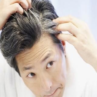 Stop Greying Hair With Natural Home Tips Remedy For White Hair, Stop Grey Hair, Grey Hair Remedies, Premature Grey Hair, Prevent Grey Hair, Reverse Gray Hair, Getting Rid Of Dandruff, Natural Gray Hair, Hair Remedies