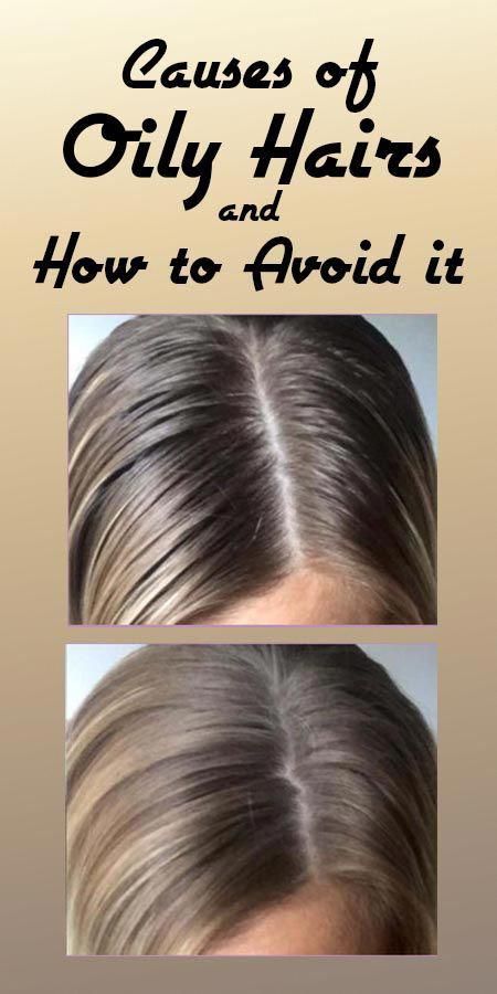 Diy Oily Hair Remedies, Essential Oils For Oily Hair, Help Oily Hair, Natural Remedies For Oily Hair, Hair Masks For Oily Scalp, Oily Scalp Hairstyles, Greasy Scalp Remedy, Diy Hair Mask For Greasy Hair, How To Stop Getting Greasy Hair