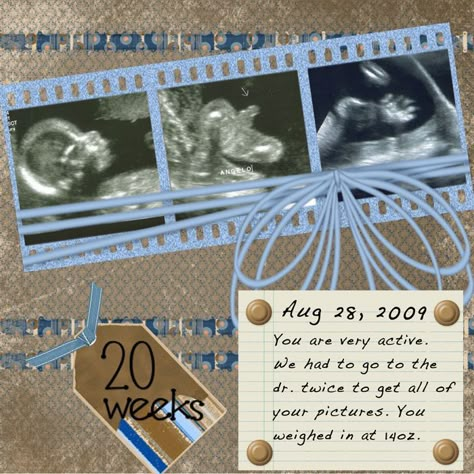 Ultrasound Scrapbook, Baby Boy Scrapbook Layouts, Pregnancy Scrapbook, Ultra Sound, Scrapbook Bebe, Boy Scrapbook Layouts, Baby Ultrasound, Baby Scrapbook Pages