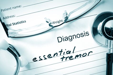 10 Treatments for Essential Tremor - Facty Health Essential Tremors Remedies, Tremors Hand, Essential Tremors, Deep Brain Stimulation, Beta Blockers, Cosmetic Injectables, Relaxation Exercises, Magnetic Resonance Imaging, Adequate Sleep