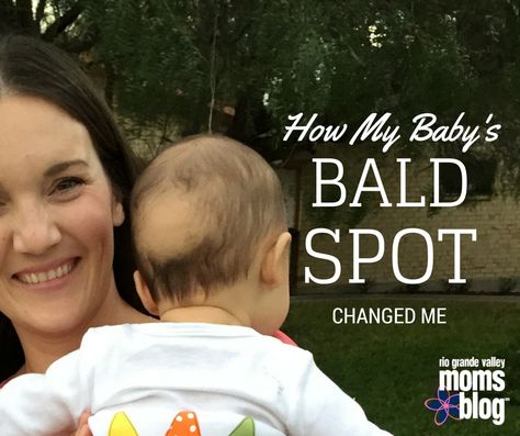 How My Baby's Bald Spot Changed Me :: RGV Moms Blog Baby Losing Hair, 4 Month Baby, Baby Boy Hairstyles, Bald Patches, Going Bald, Rio Grande Valley, Bald Spot, Bald Hair, Baby Lamb