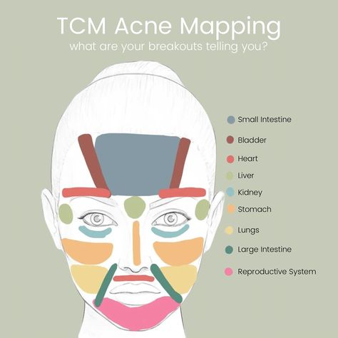 Discover the root cause of your acne with face mapping 👀 Have you ever wondered why you always break out in specific areas like your forehead, chin, or cheeks? According to Traditional Chinese Medicine, the location of your acne can reveal internal imbalances within your body. Forehead: Breakouts here often indicate a dysregulated nervous system. This could be your body’s way of signaling stress or overactivity. Incorporating calming practices like meditation or herbal adaptogens can help ... Chinese Medicine Body Map, Breaking Out On Chin, Calming Practices, Dysregulated Nervous System, Tcm Traditional Chinese Medicine, Face Mapping Acne, Acupuncture Clinic, Face Mapping, Body Map