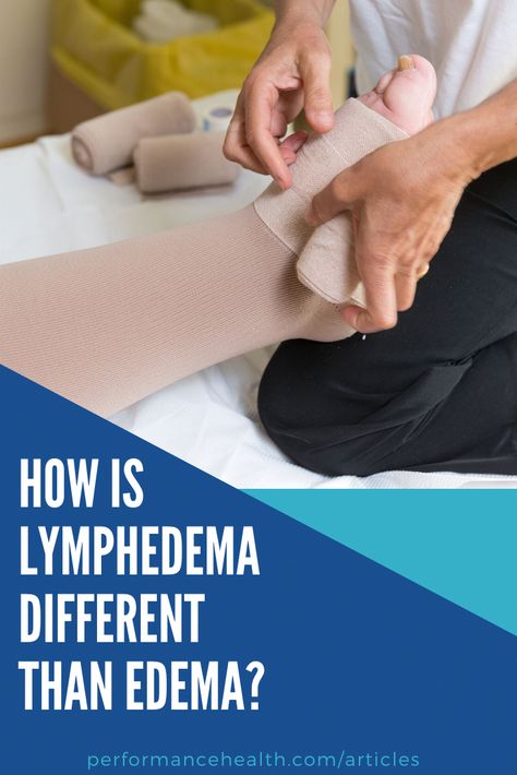 Edema and lymphedema both involve swelling, but these conditions have very different causes and are treated differently. Learn about the difference now. Edema How To Get Rid Of, Edema Remedies, Edema Causes, House Schedule, Lymph Drainage, Back Stretches For Pain, Water Retention, Skin Pores, Stomach Fat