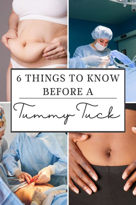 6 Things to Know Before a Tummy Tuck Abdominoplasty Plastic Surgery Beauty Abs Cosmetic Surgery Flat Stomach 6 pack Six pack bikini body beach body summer fall winter Mommy Makeover Surgery Recovery, Body Lift Surgery, Plastic Surgery Recovery, Tummy Tucks Recovery, Skin Removal Surgery, Mommy Makeover Surgery, Body Contouring Surgery, Plastic Surgery Fail, Physical Examination