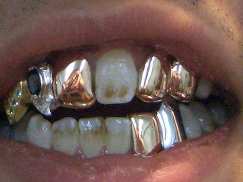 Colorful Grillz, Silver Bottom Grillz, Two Piece Grillz, Rose Gold Grillz, Open Face Gold Teeth Grillz, Dental Jewelry, Grillz Teeth, Gold Grillz, Tooth Gems