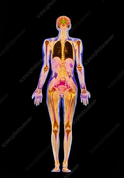 Coloured MRI scan of a whole human body (female) - Stock Image - P835/0032 - Science Photo Library Body Female, Body Scan, Mri Scan, Magnetic Resonance Imaging, Magnetic Resonance, Body Scanning, Science Photos, Meditation Art, Human Brain