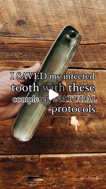 Donni :: waldorf.everyday on Instagram: "I saved my tooth, naturally!! 

My dentist gave me 2 options for my infected (and excruciatingly painful) tooth - 1. Root canal (I’m a firm NO on root canals) or 2. Extraction and zirconia implant (which would cost more than buying a horse and building a stable!)

So I gave myself a week to heal it naturally. 

This is how I did it :

I oil pulled with a teaspoon of castor oil and a drop each of therapeutic grade Oregano, Tea Tree and On Guard essential oil, for 20 minutes, three times a day. 

Within 24 hours, my tooth pain shifted from a 10, down to a 4. Within 3 days, it was completely gone. 

2 months later, my tooth still gives me no problem at all. 

Healing your tooth from infection is possible!

I have a highlight on the exact products I use Healing Cavity Naturally, Tooth Pain Relief Severe, Absessed Tooth, Oregano Tea, Buying A Horse, On Guard Essential Oil, Tooth Pain Relief, Rotten Teeth, Teeth Remedies