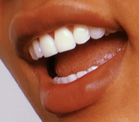 Perfect white teeth and lips aesthetic Desired Teeth, Perfect White Teeth, Teeth Reference, Loose Teeth, Teeth Aesthetic, Lips Aesthetic, Goals 2023, Pretty Teeth, Teeth Pictures