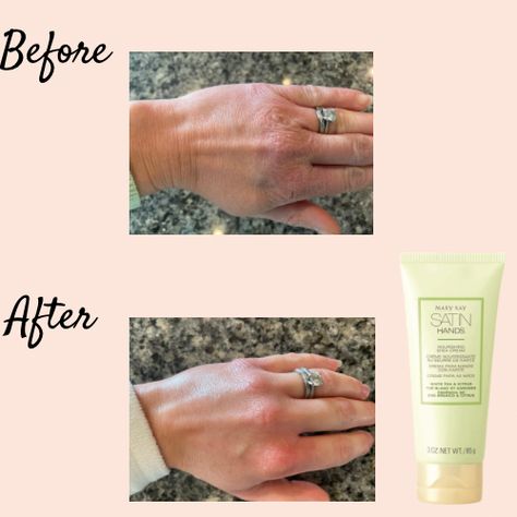 Transformation of my hands using Mary Kay Satin Hands. Mary Kay Satin Hands Set, Mary Kay Satisfaction Guarantee, Mary Kay Indulge Soothing Eye Gel, The Newcomer Mary Kay Andrews, Mary Kay Satin Hands, Mary Kay 20% Off Sale, Mary Kay 100% Satisfaction, Advanced Skin Care, Satin Hands