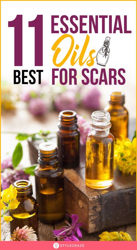 Scar Fading Remedies, Essential Oils For Scar Tissue, Essential Oil For Scars, Essential Oils For Healing Skin Wounds, Essential Oils For Burns On Skin, Natural Scar Remedies, Essential Oils For Scars After Surgery, How To Fade Scars, Scar Healing Essential Oils