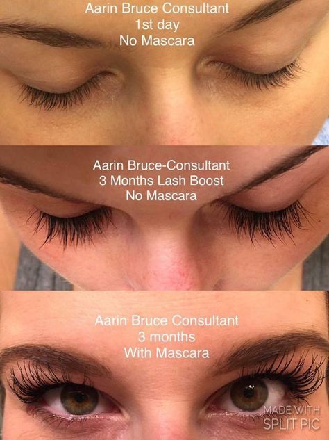 Lashes for days with Rodan and Fields Lashboot! www.phale1.myrandf.com Lash Boost Rodan And Fields, Before And After Lashes, Lashes Serum, Rodan Fields Skin Care, Rodan Fields Lash Boost, Lash Boost, Life Changing Skincare, Eyelash Serum, Lash Serum