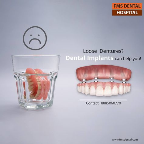 Dental Implant help your Loose Dentures. FMS INTERNATIONAL DENTAL CENTER, JUBILEE HILLS and FMS Dental Hospital, Koti, Hyderabad, are the exclusive Centers for Oral & Maxillofacial Surgery and Dental Implants. All On Four Dental Implants, Dental Banner, Dental Campaign, Dentist Advertising, Implant Dental, Dental Post, Dental Ads, Tooth Implant, Maxillofacial Surgery