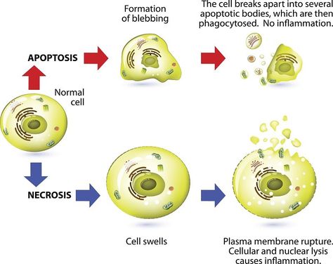 Apoptosis Vs Necrosis, Necrosis Pathology, Basic Microbiology, Medical Dictionary, Plasma Membrane, Study Biology, Pa School, Medical Laboratory Science, Phlebotomy