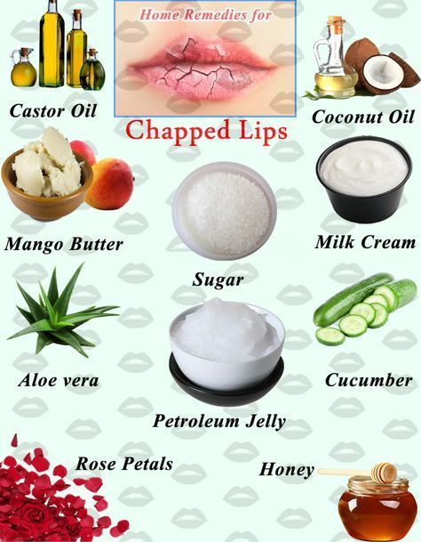 Soft, plump and glossy lips look amazing as we all want that kind of lips. Because pink lips not only look awesome but they also enhance your beauty. But some of use are not looks that much.  #chappedlips #remedies #homeremedies #natural #skincare #skincaretips Lip Remedies, Remedies For Chapped Lips, Lips Remedies, Dry Lips Remedy, Chapped Lips Remedy, Dry Lip, Lips Care, Lip Care Routine, Homemade Lip Balm